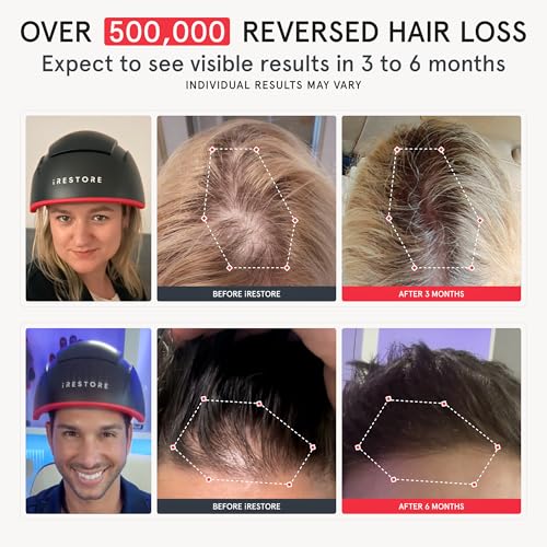 Elite Laser Hair Growth System N380